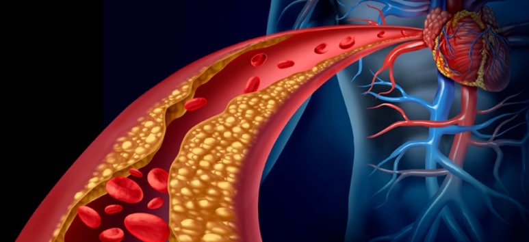 niveles de colesterol en sangre tabla